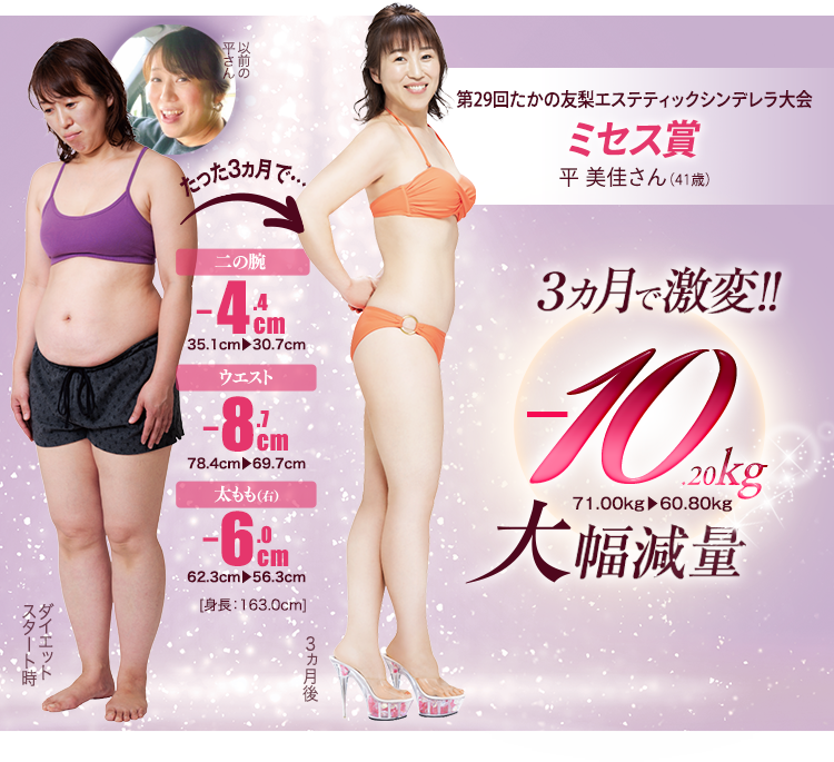 第29回たかの友梨エステティックシンデレラ大会 ミセス賞 平 美佳さん