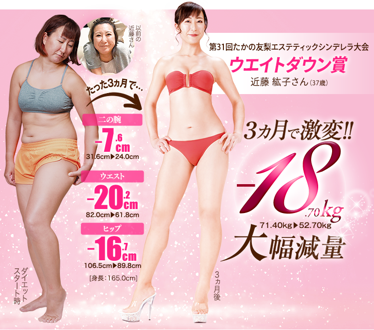 第30回たかの友梨エステティックシンデレラ大会 ウエイトダウン賞 原 彩さん